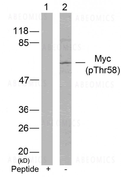 Anti-phospho-Myc (Thr58)