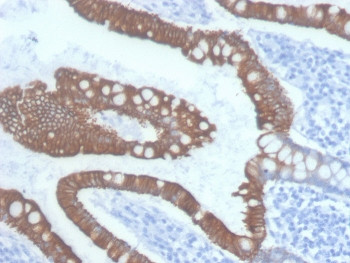 Anti-Cytokeratin 20 / CK20, clone KRT20/3145