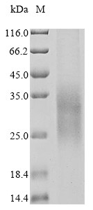 Triggering receptor expressed on myeloid cells 2 (TREM2), partial, human, recombinant