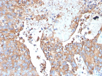 Anti-Uroplakin 1B / UPK1B, clone UPK1B/3273