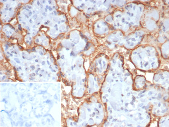 Anti-HCG-beta / Choriogonadotropin subunit beta, clone HCGb/7512R