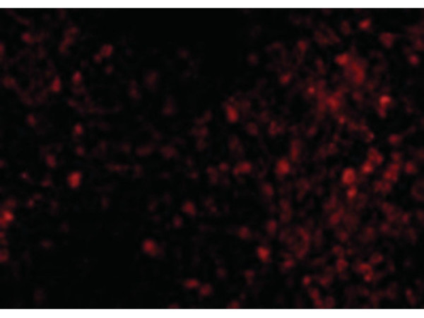 Anti-TRPC6