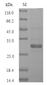 Sal-like protein 2 (SALL2), partial, human, recombinant