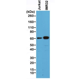 Anti-SMAD4, clone RM277 (recombinant antibody)