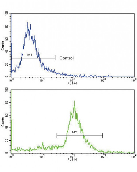 Anti-ALDH6A1