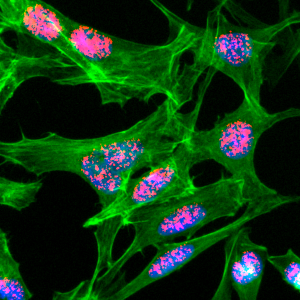 Anti-Acetyl-Histone H3 (Lys23), Rabbit Monoclonal (RM169)