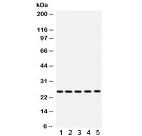 Anti-Superoxide Dismutase 2 / SOD2