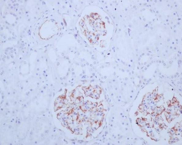 Anti-Mast Cell Tryptase