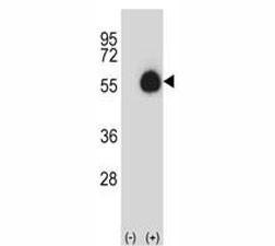Anti-CD33