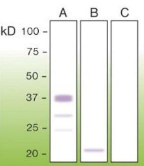 Anti-Prion, clone T16-R