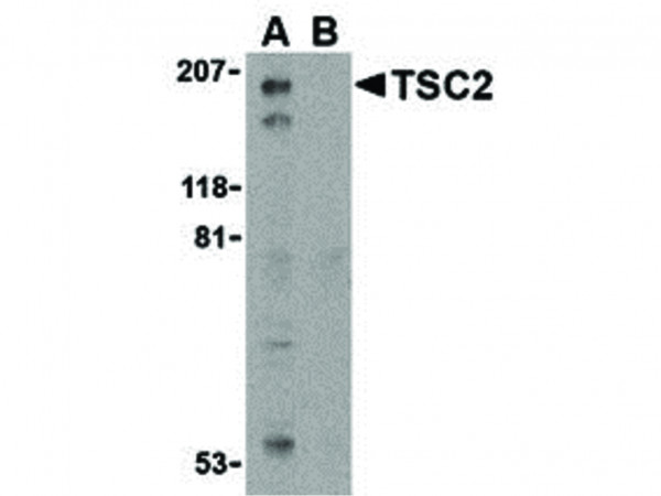 Anti-TSC2