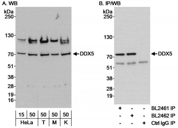 Anti-DDX5