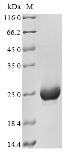 Kinase suppressor of Ras 1 (KSR1), partial, human, recombinant