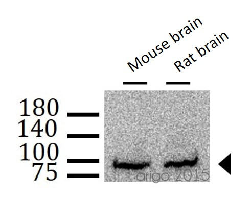 Anti-Amyloid Precursor Protein