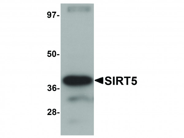 Anti-SIRT5