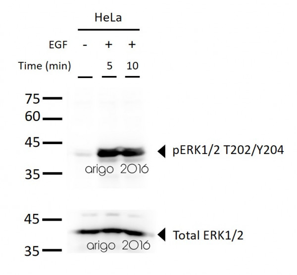Phospho-ERK1/2 MAPK Antibody Duo (Total, pT202/Y204)