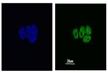 Anti-hnRNP H