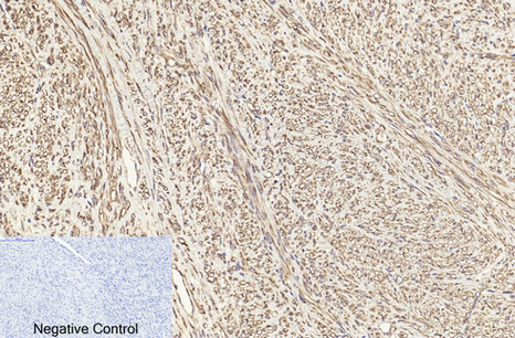 Anti-beta Tubulin, clone 3F7