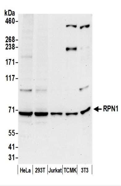 Anti-RPN1/Ribophorin I