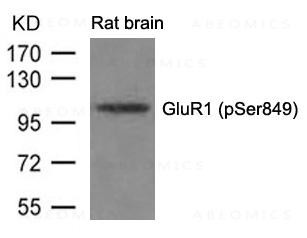 Anti-GluR1 (phospho-Ser849)