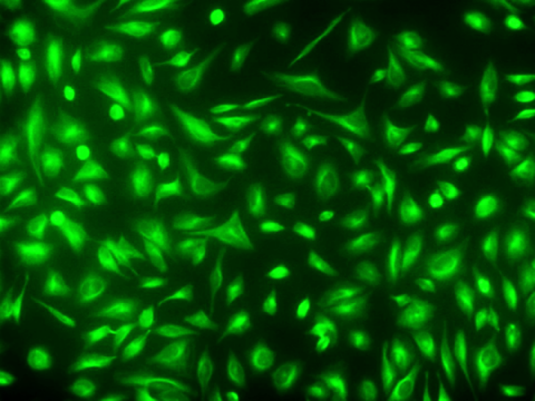 Tubulite(TM) Green *Cell-Permeable*