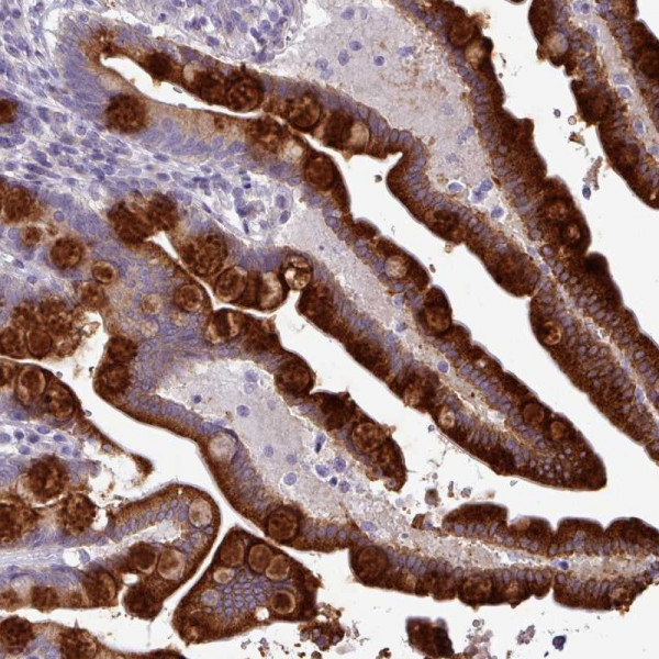 Anti-TOR1AIP2