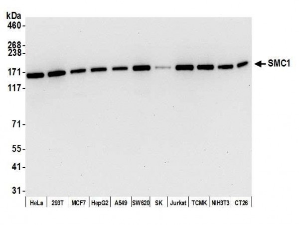 Anti-SMC1 Recombinant Monoclonal