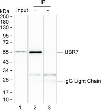 Anti-UBR7