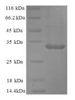 Carbonic anhydrase 12 (CA12), partial, human, recombinant