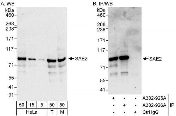 Anti-SAE2