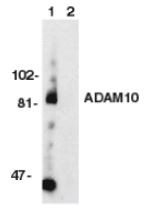 Anti-ADAM10 /KUZ / MADM