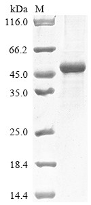 Collagen alpha-2 (IV) chain (COL4A2), partial, human, recombinant