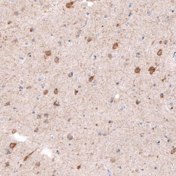 Anti-CDKL5, clone CL4881