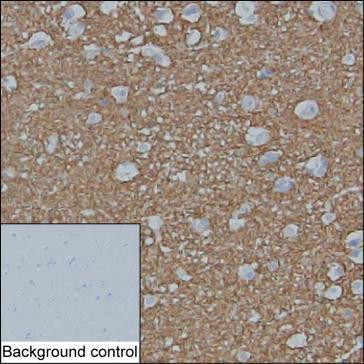 Anti-alpha Synuclein