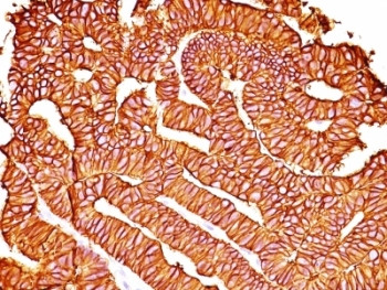 Anti-EpCAM, clone SPM528