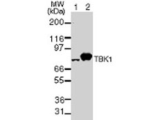 Anti-TBK1, clone 108A429