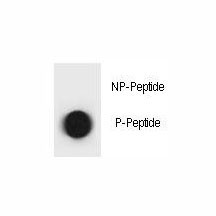 Anti-phospho-TSC1 (Thr310)