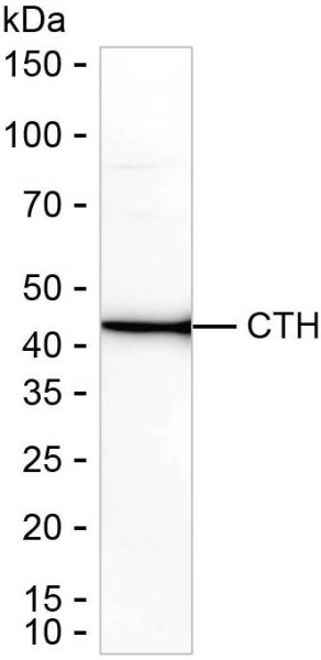 Anti-Cystathionase/CTH