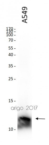 Anti-S100A4, clone 3D10-B4-D10
