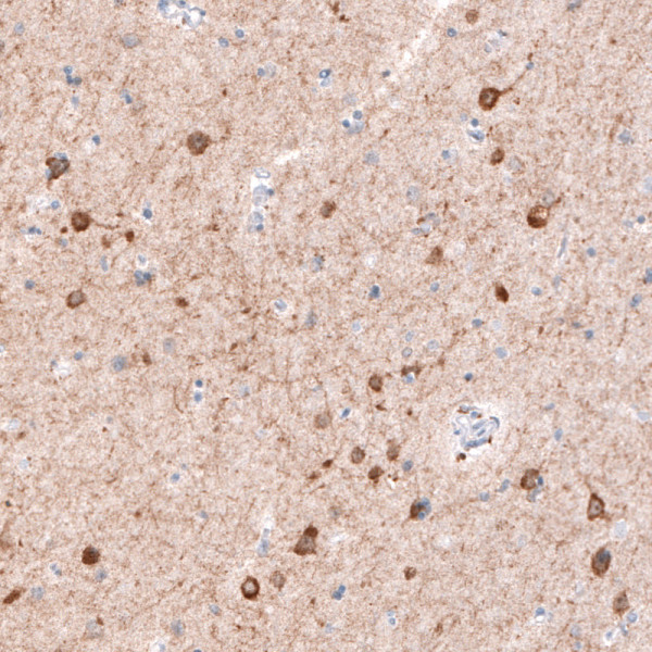 Anti-CDKL5, clone CL4888