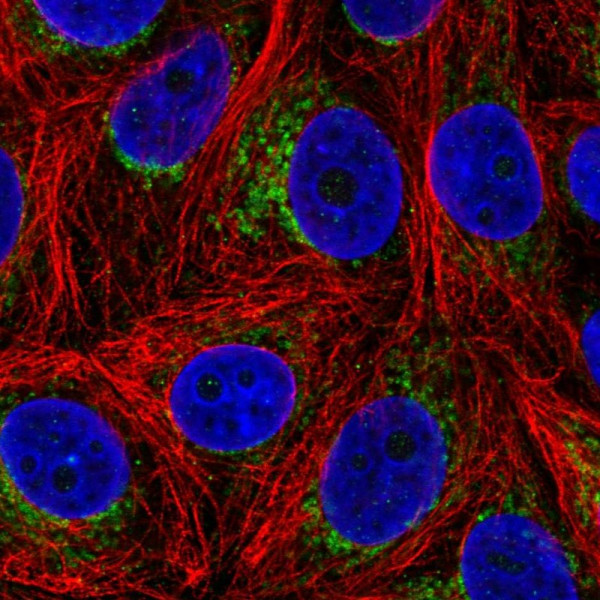 Anti-ALDH6A1