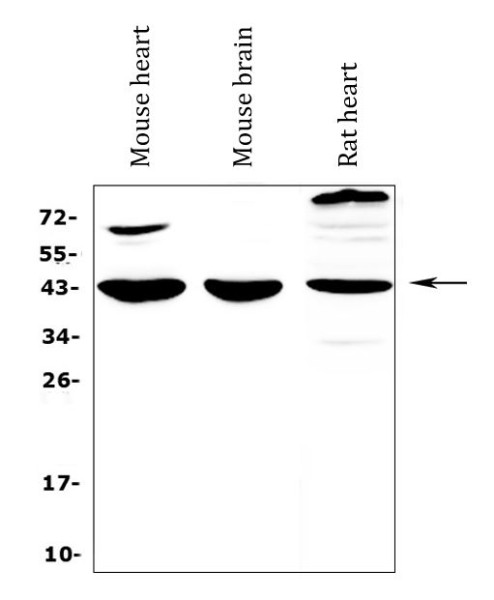 Anti-IL18 binding protein