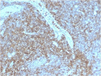 Anti-CD44 / HCAM, clone HCAM/2875R
