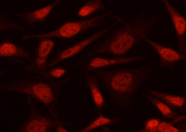 Anti-MAX/MYC associated factor X Monoclonal Recombinant Antibody