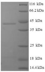 Deoxyguanosine kinase, mitochondrial (DGUOK), human, recombinant