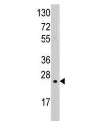 Anti-Superoxide Dismutase 2 Antibody (SOD2)
