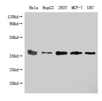 Anti-PPA1 Monoclonal, clone 1H4E1