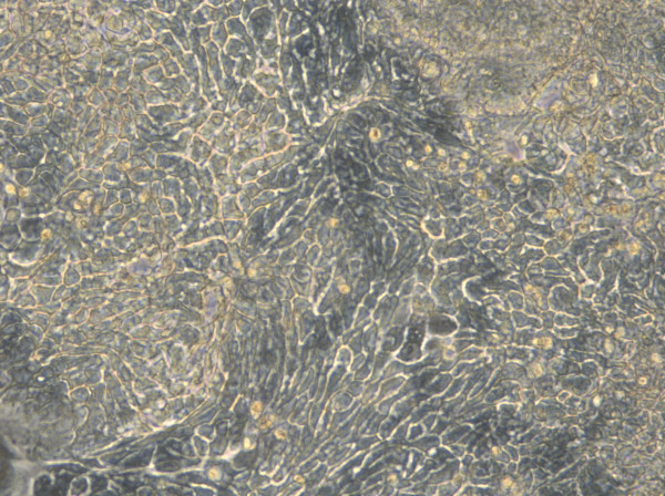 HROC183 Cells