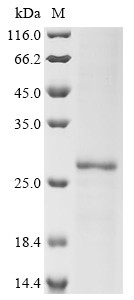 Uroplakin-2 (UPK2), human, recombinant