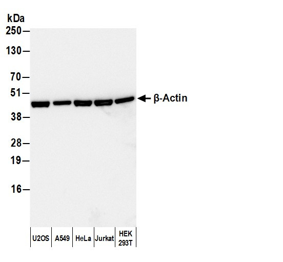 Anti-Rabbit IgG-heavy and light chain, HRP conjugated